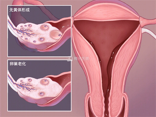 卵巢储备功能减退，试管婴儿的“希望之路”如何走？插图(1)